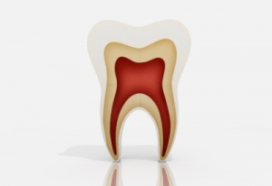 tratamiento periodontitis