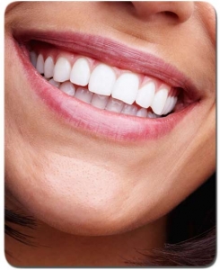 blanqueamiento dental clinica Gijon