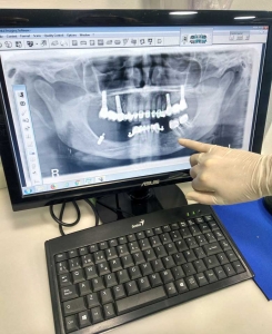 diagnostico digital clinica dental gijon