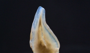 endodoncia