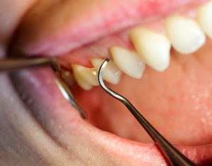 higiene oral gijon