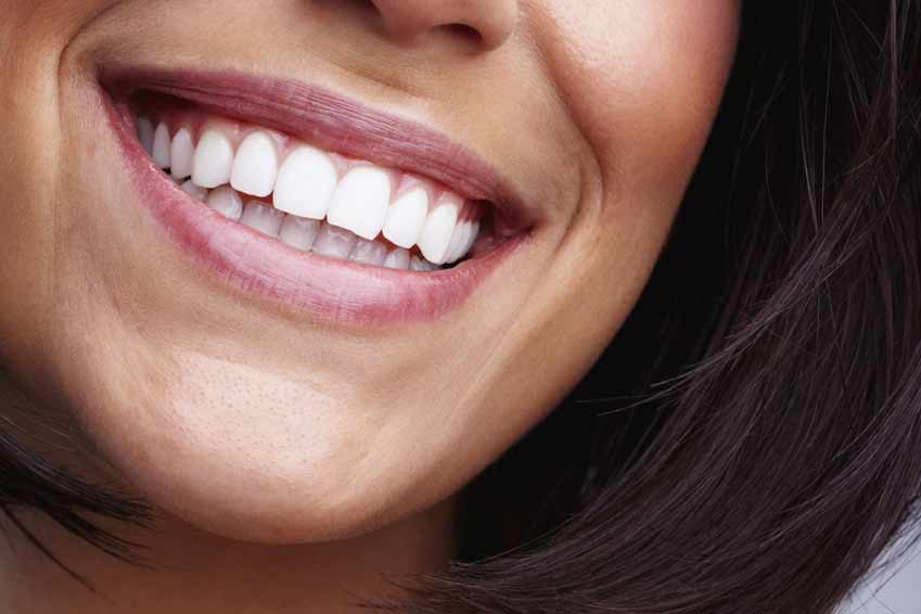 Logro No puedo jurar Clínica dental en Gijón – 8 claves para tener una sonrisa bonita