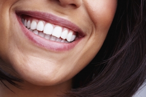 blanqueamiento dental
