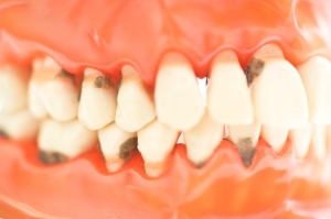 periodoncia gijon