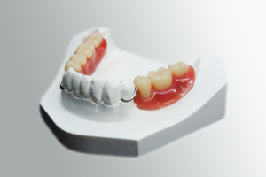 rehabilitación oral gijon