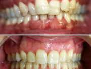 caso de ortodoncia