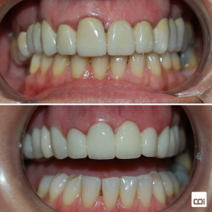caso de estética dental