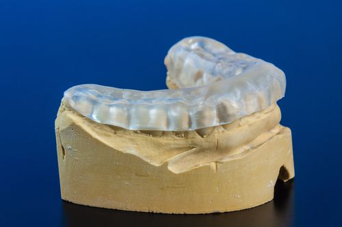 Bruxismo - Férula de descarga - Clínica Dental en Majadahonda