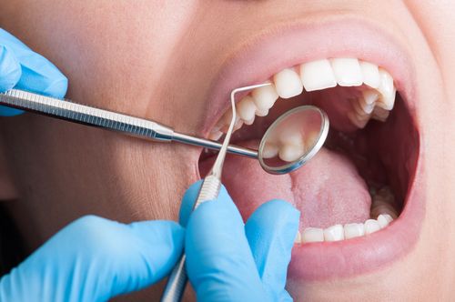 limpieza dental en clinica gijon