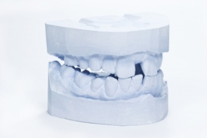 desgaste dental