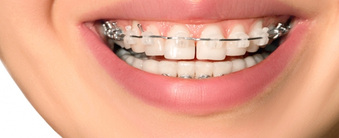 ortodoncia gijon