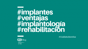 ventajas implantes dentales