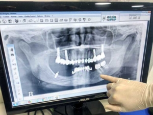 diagnóstico digital clinica dental Gijón