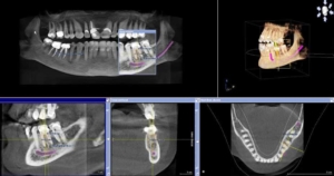 odontología digital