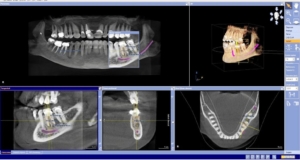 odontología digital Gijón