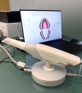 escaner intraoral