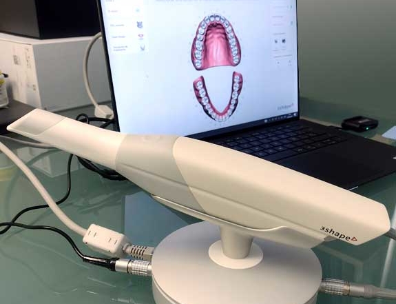 Ventajas del escáner intraoral 3D