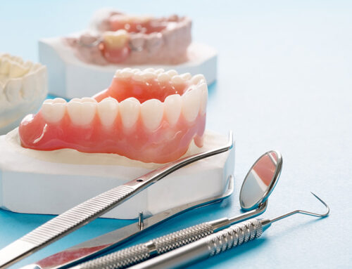 Adhesivos dentales: tipos y recomendaciones de uso