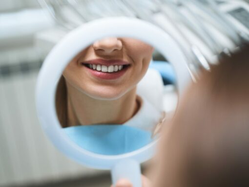 blanqueamiento-dental-gijon-asturias-odontologia-1