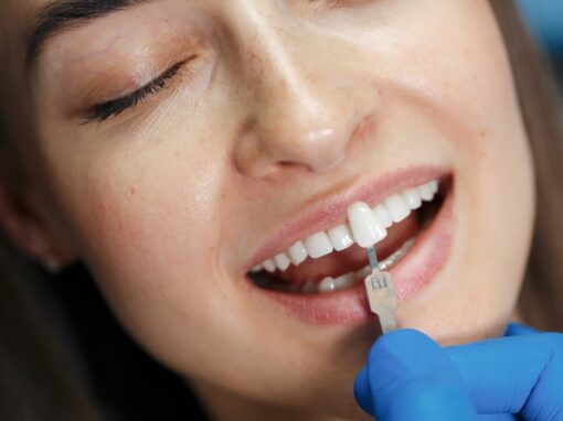 carillas-dentales-estetica-dental-gijon-1
