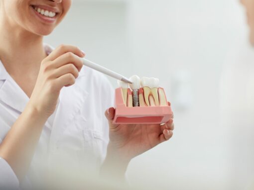 implantes-dentales-gijon-1