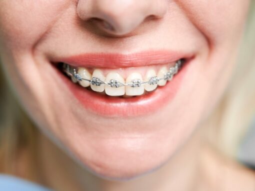 ortodoncia-gijon-brackets-odontologia-2