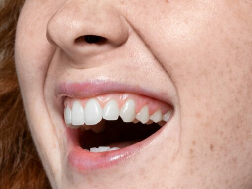 periodoncia-encias-gengivitis-clinica-en-gigjon