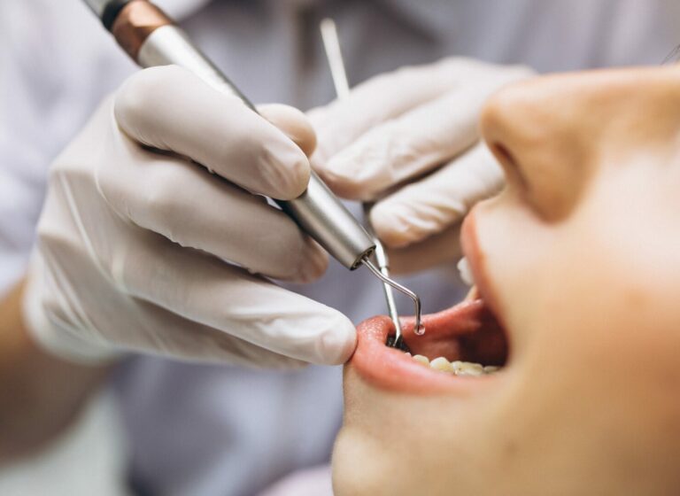 tratamiento-endodoncia-gijon-asturias-1