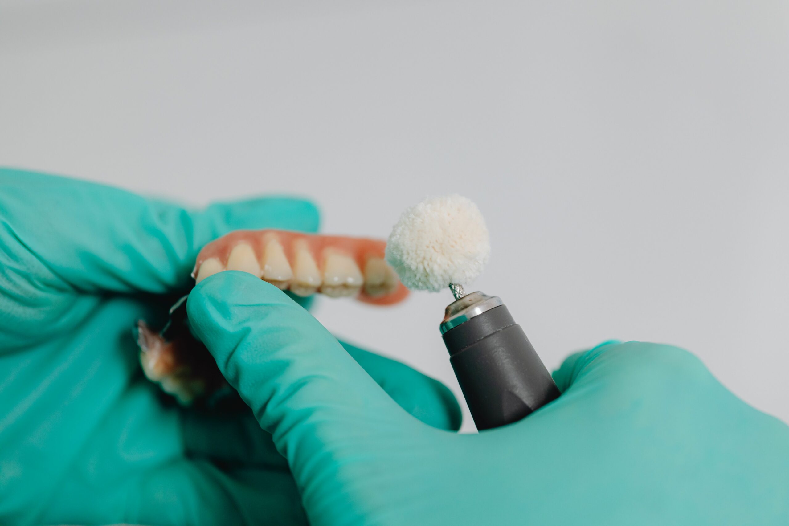 ¿Puedo ponerme Implantes si he perdido hueso? Injerto y regeneración ósea en Gijón